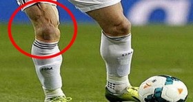 bale-in-bu-hali-olay-yaratti-futbolistan