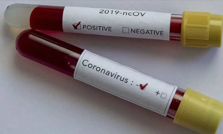 Beşiktaş'ta şok üstüne şok! 1 koronavirus testi negatif pozitif